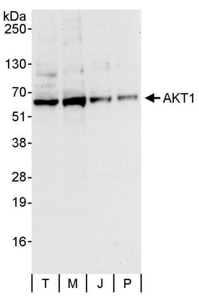 Anti-AKT1