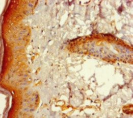Anti-ZNF260