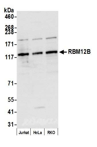Anti-RBM12B