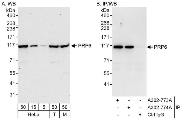 Anti-PRP6