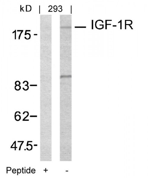 Anti-IGF-1R