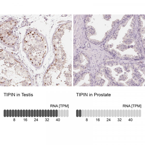 Anti-TIPIN