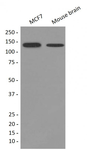 Anti-Growth hormone receptor