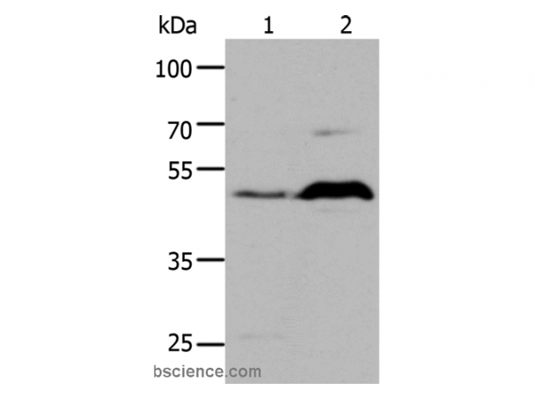 Anti-HTR1A