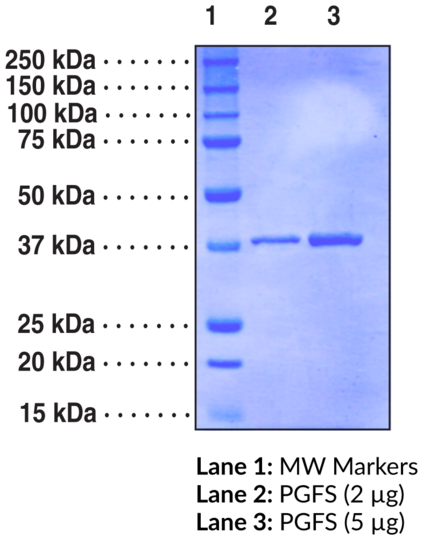 Prostaglandin F Synthase (human recombinant)