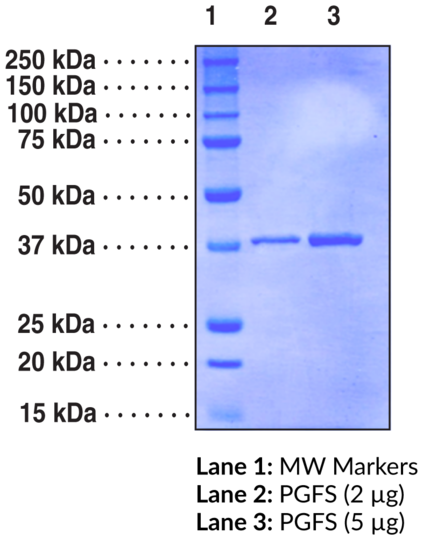 Prostaglandin F Synthase (human, recombinant)