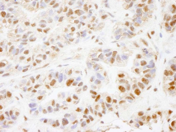 Anti-PHF8 (IHC)