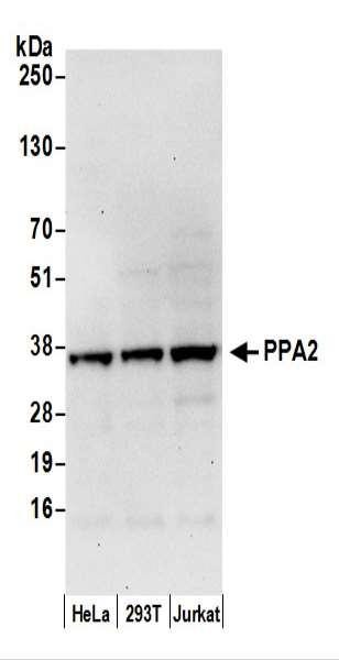Anti-PPA2
