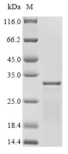 ESAT-6-like protein EsxB (esxB), Mycobacterium tuberculosis, recombinant