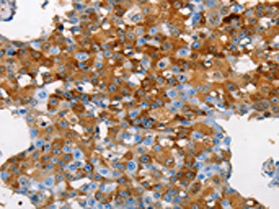 Anti-MUC5B