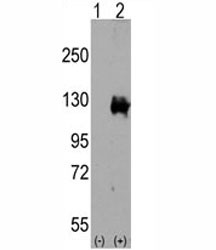 Anti-TRPM8