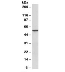 Anti-Epoxide hydrolase 2