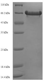 Trigger factor (tig), Escherichia coli O127:H6, recombinant