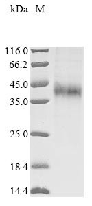Asialoglycoprotein receptor 1 (Asgr1), partial, rat, recombinant