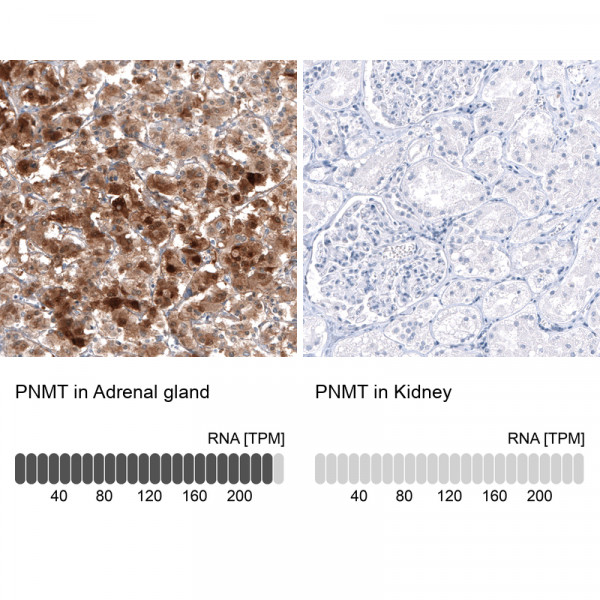 Anti-PNMT, clone CL11434