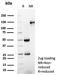 Anti-ICAM1 / CD54, clone ICAM1/8247R