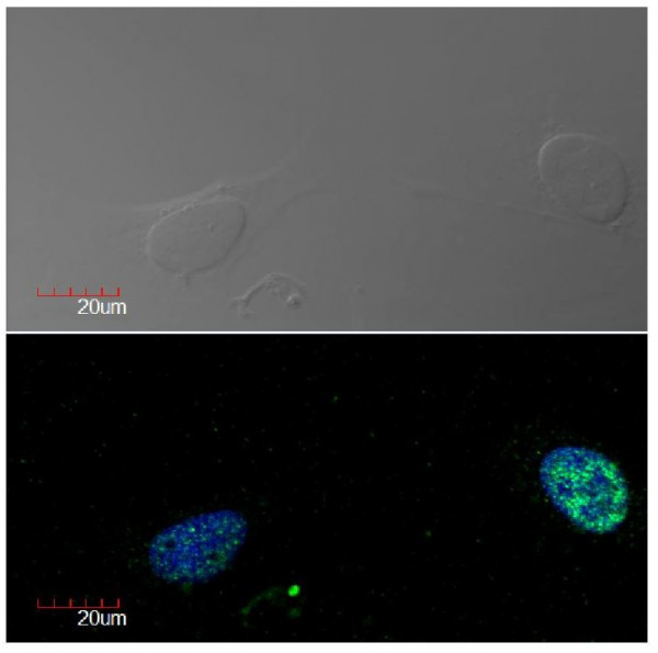 Anti-Ki-67, clone Ki-67