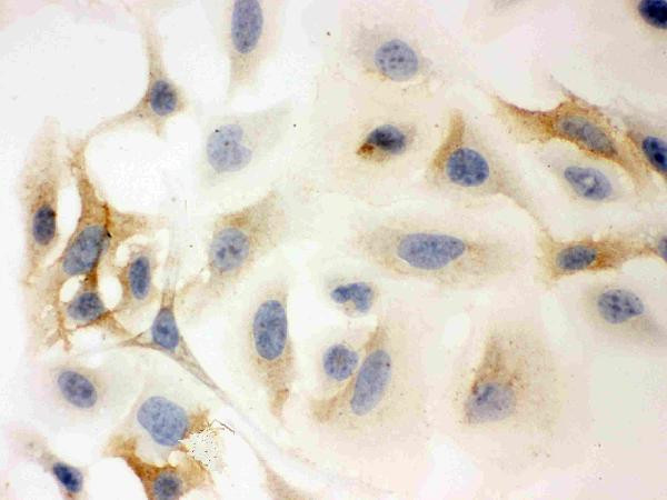 Anti-HLA C