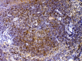 Anti-CTLA-4 / CD152