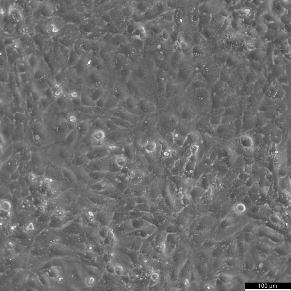 MET-5A Cells