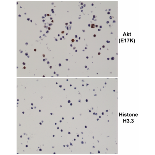Anti-Akt (E17K Mutant) (human), Rabbit Monoclonal (RM336) (Biotin)