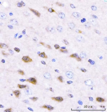 Anti-Adgrg1 / Gpr56 / Adhesion G-protein coupled receptor G1