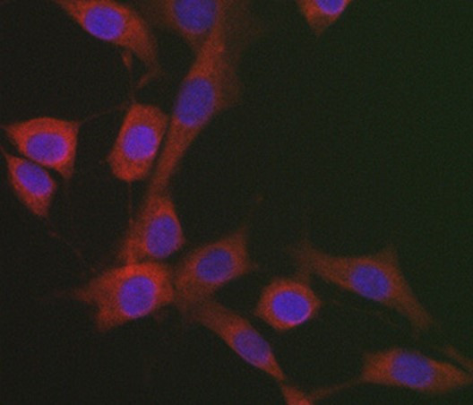 Anti-Hsp 47