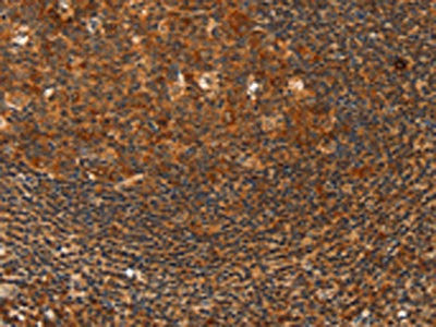 Anti-HDAC8