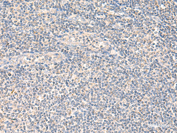 Anti-NEGR1