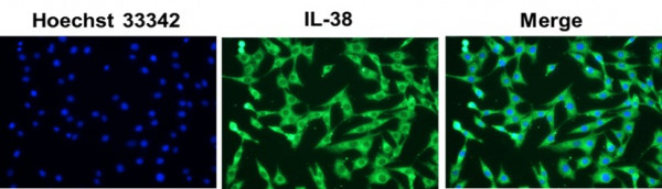 Anti-IL38, clone SQab18124
