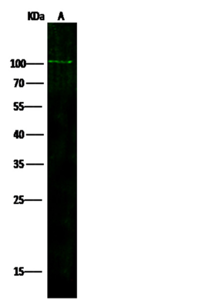 Anti-ADAM12 Monoclonal Recombinant Antibody