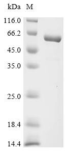Inosine-5'-monophosphate dehydrogenase 2 (IMPDH2), partial, human, recombinant