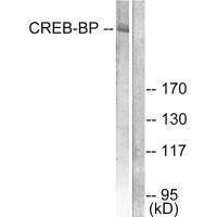 Anti-CREBBP