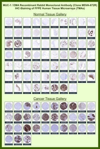 Anti-MUC1 for IHC / Mucin 1, clone MSVA-672R