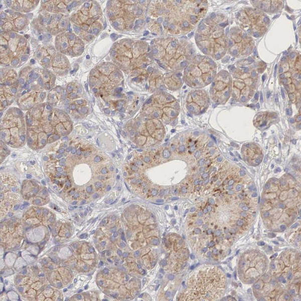 Anti-PCDH11X