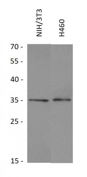 Anti-SFTPA1 + SFTPA2