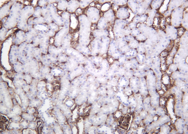 Anti-Recombinant Annexin II, clone 7B4
