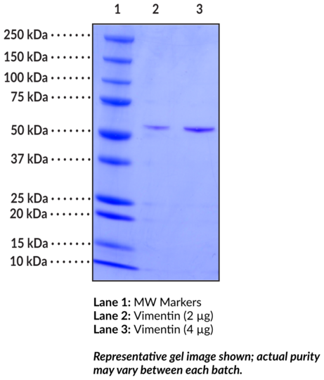 Vimentin (human, recombinant)