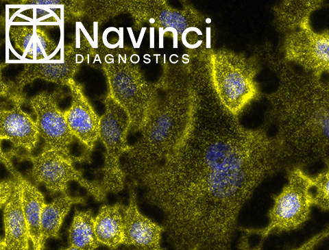 Navinci_Preview