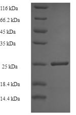 Tubulinyl-Tyr carboxypeptidase 1 (VASH1), human, recombinant