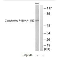 Anti-CYP4A11/CYP4A22