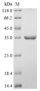 Acetoacetate decarboxylase (adc), Clostridium acetobutylicum, recombinant