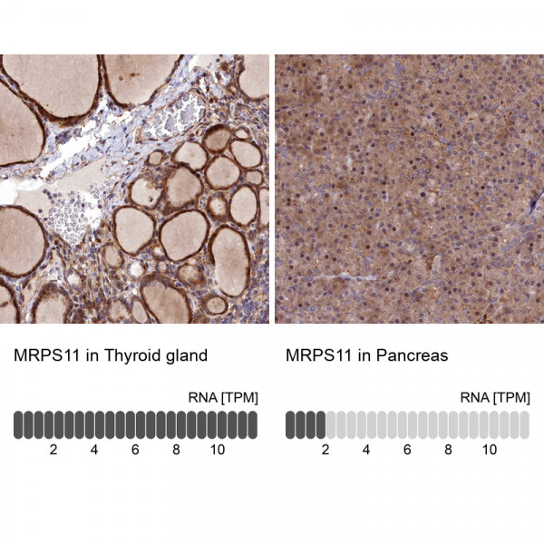 Anti-MRPS11