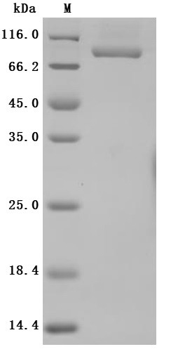 Transferrin receptor protein 1 (TFRC), partial (Active), human, recombinant
