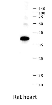 Anti-Cardiac Troponin T, clone 1F11