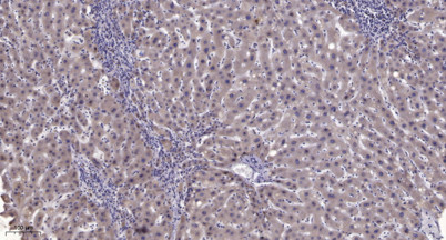 Anti-phospho-PC-PLD1 (Thr147)