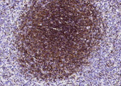 Anti-Ly108/SLAMF6 Monoclonal Recombinant Antibody