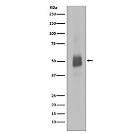 Anti-phospho-LYN (Tyr396), clone IFI-12
