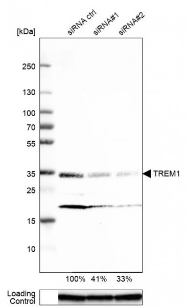 Anti-TREM1, clone CL7111