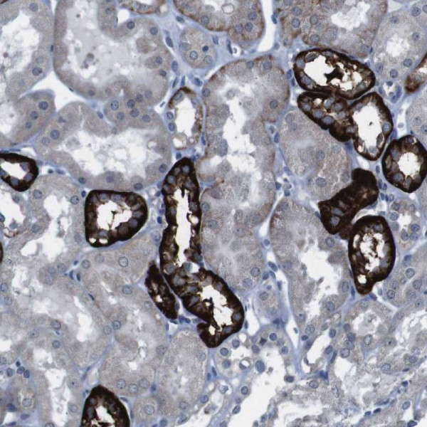 Anti-CDH22